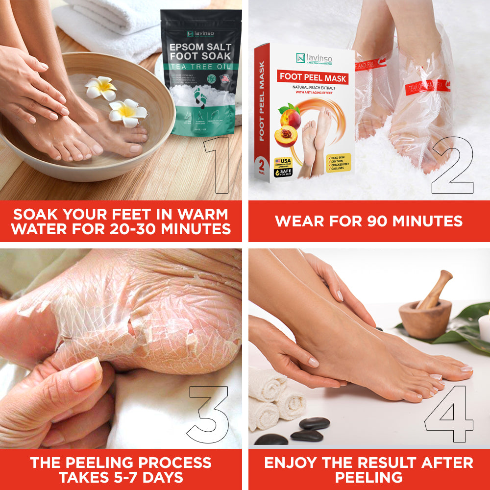 Peach Foot Peel Mask - for Dry Cracked Feet - Remove Dead Skin and Cal –  Lavinso