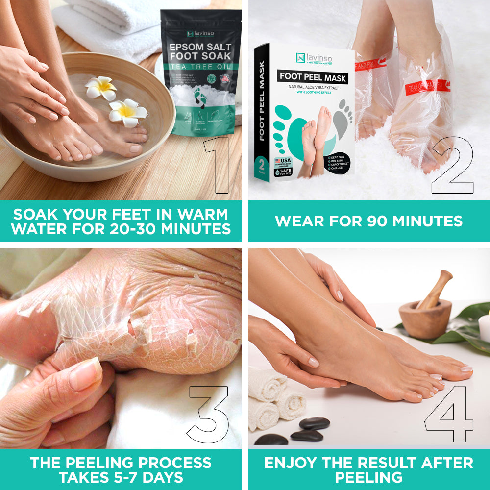 Foot Peel Mask — Removes Calluses and Dead Skin Cells | Lavinso
