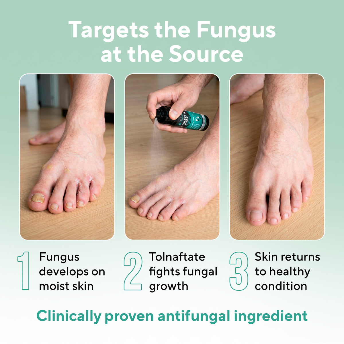 Lavinso Athlete's Foot Antifungal Spray with Tolnaftate 1%